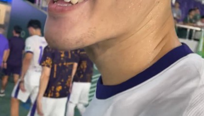 华体会首页-津门虎0-2负浙江遭遇失利，中卫王献钧拼抢中门牙遭撞击脱落